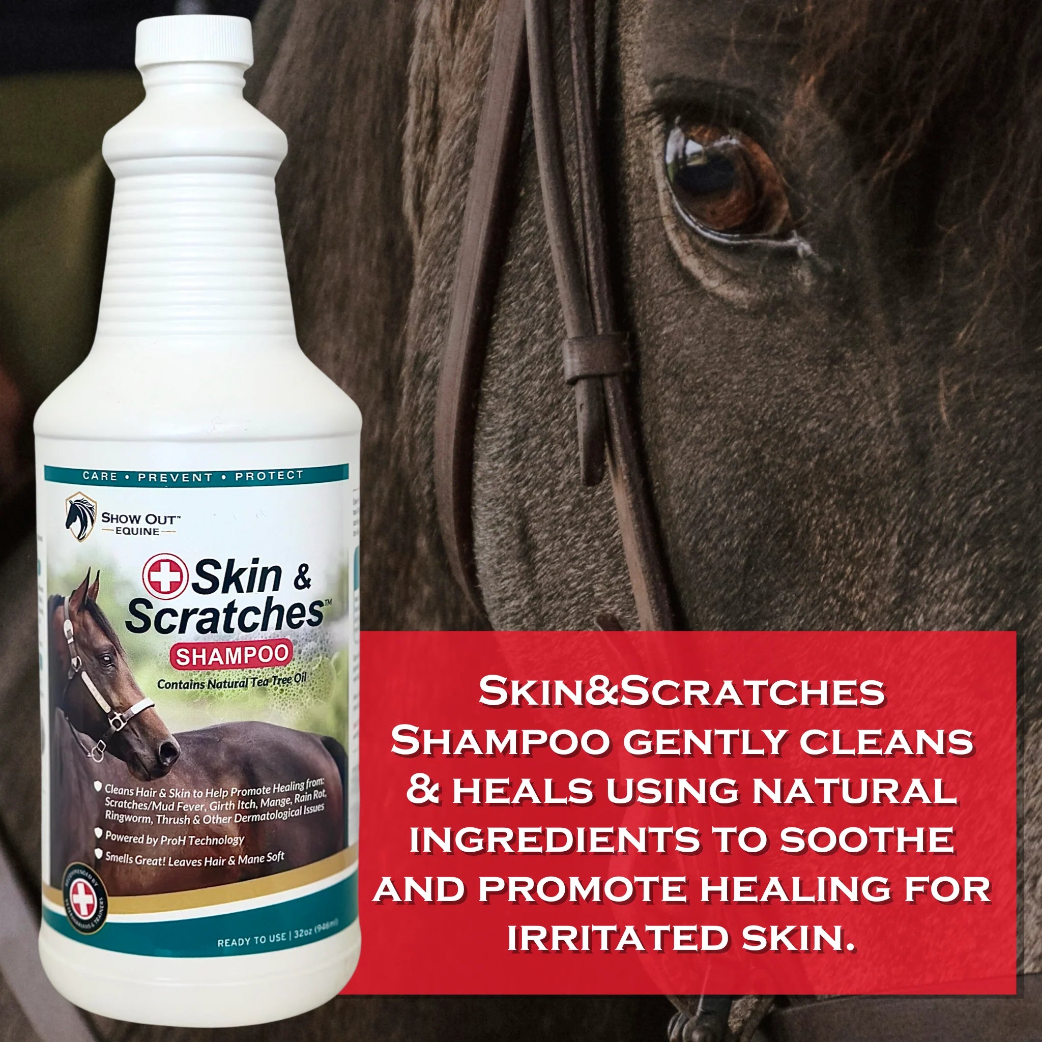 Show Out Skin & Scratches Prevention Pack - Fast Relief and Prevention for Horse Care. Use on Equine Scratches/Mud Fever, Girth Itch, Mange, Thrush, Rain Rot, Ringworm & Other Skin Issues on Horses